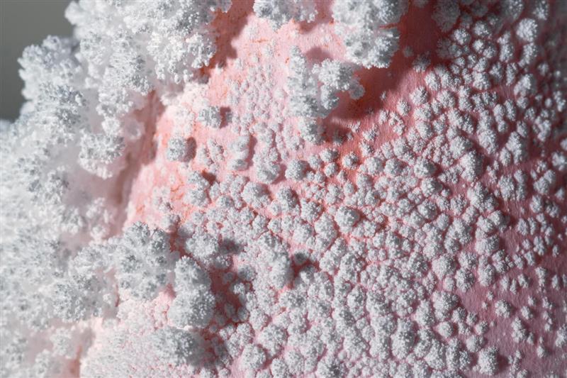 mould allergy